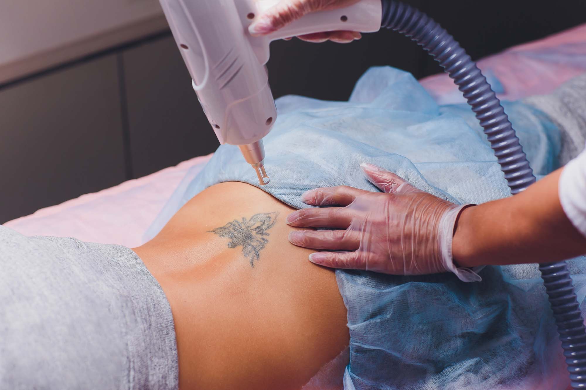 RUSH HOUR: Botched tattoo removal leaves mum horrified | news.com.au —  Australia's leading news site